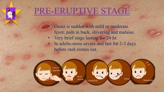 PRE-ERUPTIVE STAGE
• Onset is sudden with mild or moderate
fever, pain in back, shivering and malaise.
• Very brief stage lasting for 24 hr.
• In adults-more severe and last for 2-3 days
before rash comes out.
22
 
