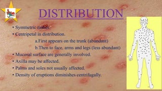 Dense Vs Diffuse Rash Chickenpox | PPTX