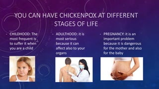 YOU CAN HAVE CHICKENPOX AT DIFFERENT
STAGES OF LIFE
- ADULTHOOD: it is
most serious
because it can
affect also to your
organs
- PREGNANCY: it is an
important problem
because it is dangerous
for the mother and also
for the baby
- CHILDHOOD: The
most frequent is
to suffer it when
you are a child