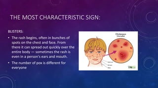 THE MOST CHARACTERISTIC SIGN:
BLISTERS:
• The rash begins, often in bunches of
spots on the chest and face. From
there it can spread out quickly over the
entire body — sometimes the rash is
even in a person's ears and mouth.
• The number of pox is different for
everyone