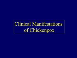 Clinical Manifestations
of Chickenpox