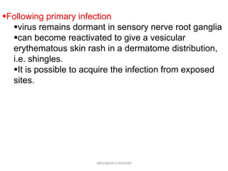 Following primary infection
virus remains dormant in sensory nerve root ganglia
can become reactivated to give a vesicular
erythematous skin rash in a dermatome distribution,
i.e. shingles.
It is possible to acquire the infection from exposed
sites.
ABOUBAKR ELNASHAR
 