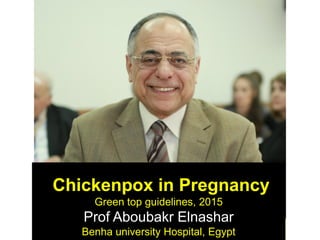 Chickenpox in Pregnancy
Green top guidelines, 2015
Prof Aboubakr Elnashar
Benha university Hospital, Egypt
 
