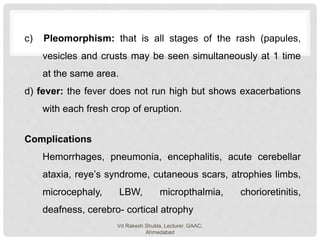 Chicken pox | PPTX