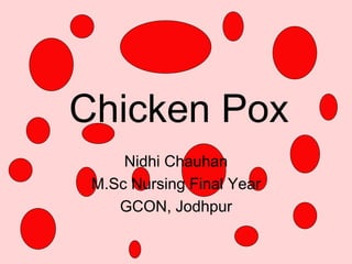 Chicken Pox
Nidhi Chauhan
M.Sc Nursing Final Year
GCON, Jodhpur
 