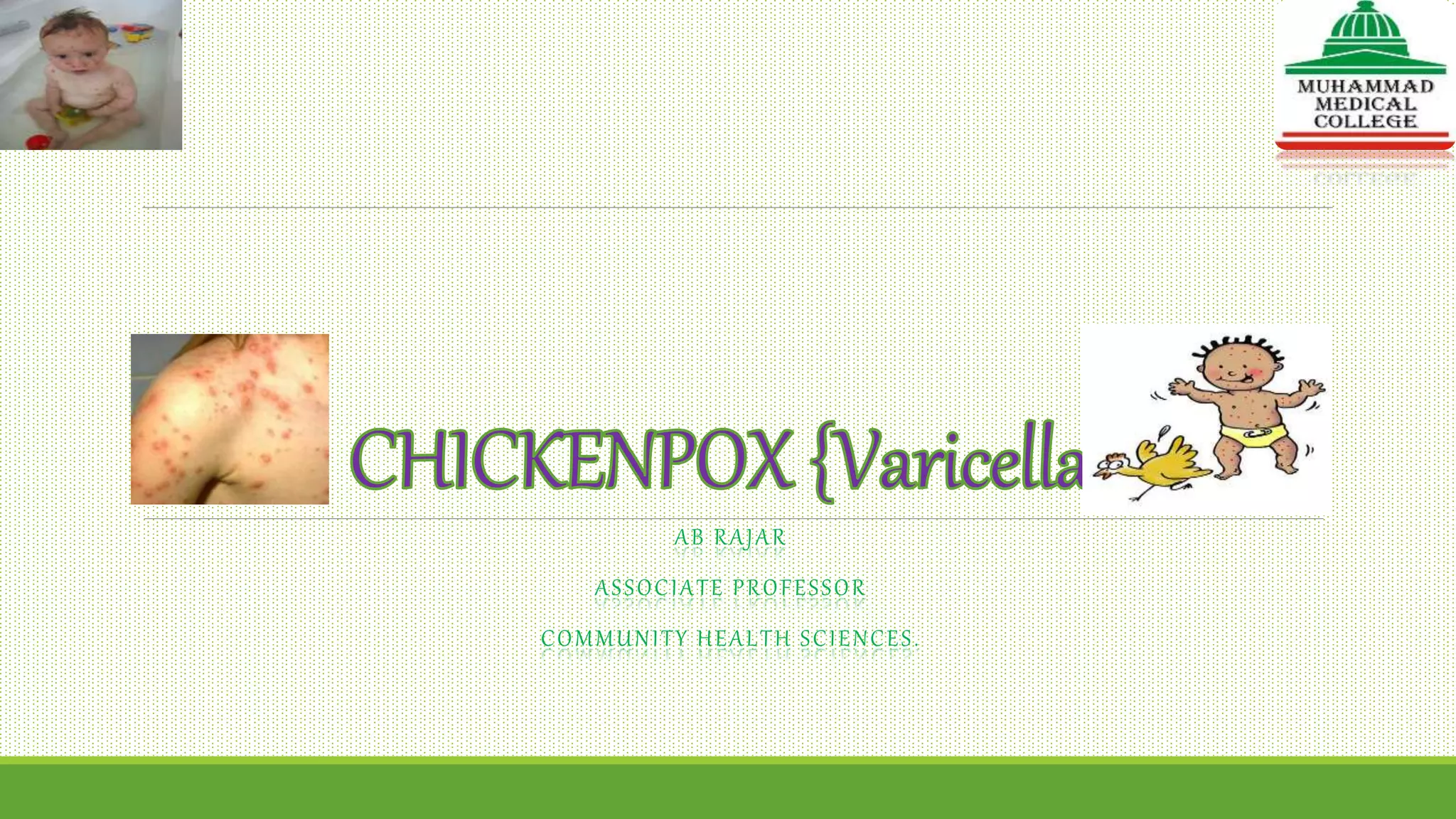 Epidemiology and control measures for CHICKENPOX {Varicella} | PPTX