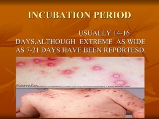 INCUBATION PERIOD
USUALLY 14-16
DAYS,ALTHOUGH EXTREME AS WIDE
AS 7-21 DAYS HAVE BEEN REPORTESD.
 