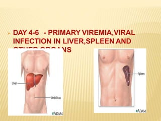  DAY 4-6 - PRIMARY VIREMIA,VIRAL
INFECTION IN LIVER,SPLEEN AND
SOTHER ORGAN
 