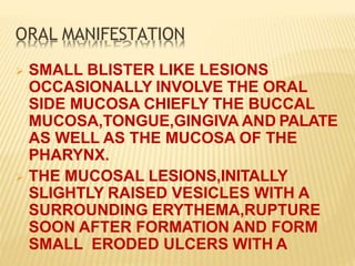 ORAL MANIFESTATION
 SMALL BLISTER LIKE LESIONS
OCCASIONALLY INVOLVE THE ORAL
SIDE MUCOSA CHIEFLY THE BUCCAL
MUCOSA,TONGUE,GINGIVA AND PALATE
AS WELL AS THE MUCOSA OF THE
PHARYNX.
 THE MUCOSAL LESIONS,INITALLY
SLIGHTLY RAISED VESICLES WITH A
SURROUNDING ERYTHEMA,RUPTURE
SOON AFTER FORMATION AND FORM
SMALL ERODED ULCERS WITH A
 