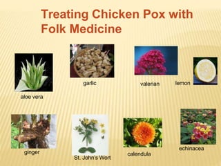Treating Chicken Pox with
Folk Medicine
garlic lemonvalerian
aloe vera
St. John’s Wort
calendula
echinacea
ginger
 