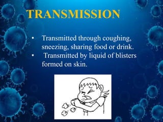 • Transmitted through coughing,
sneezing, sharing food or drink.
• Transmitted by liquid of blisters
formed on skin.
TRANSMISSION
 
