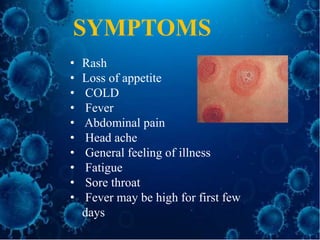 • Rash
• Loss of appetite
• COLD
• Fever
• Abdominal pain
• Head ache
• General feeling of illness
• Fatigue
• Sore throat
• Fever may be high for first few
days
SYMPTOMS
 