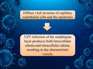 Diffuse viral invasion of capillary
endothelial cells and the epidermis
VZV infection of the malphigian
layer produces both intercellular
edema and intracellular edema,
resulting in the characteristic
vesicle.
 