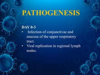 DAY 0-3
• Infection of conjunctivae and
mucosa of the upper respiratory
tract.
• Viral replication in regional lymph
nodes.
PATHOGENESIS
 