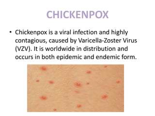 COMMUNICABLE DISESE, CHICKEN POX ADULT HEALTH NURSING PPT | PPTX