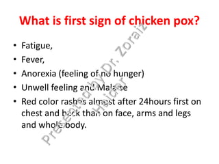 Chicken pox | PDF
