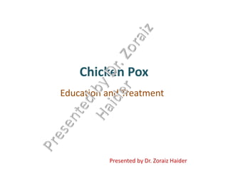Chicken Pox
Education and Treatment
 