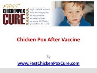 Chicken Pox After Vaccine

            By
www.FastChickenPoxCure.com
 