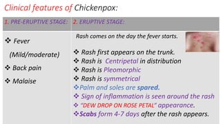 Chickenpox and Smallpox.PSM,COMMUNITY MEDICINE,DR NARENDRA KUMAR YADAV ...