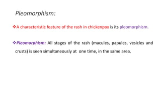 Chickenpox and Smallpox.PSM,COMMUNITY MEDICINE,DR NARENDRA KUMAR YADAV ...