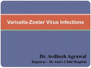 Dr. Avdhesh Agrawal
Registrar – Dr Atul’s Child Hospital
Varicella-Zoster Virus Infections
 