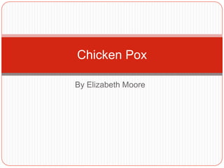 Chicken Pox

By Elizabeth Moore
 