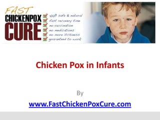 Chicken Pox in Infants

            By
www.FastChickenPoxCure.com
 