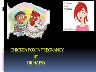 CHICKEN POX IN PREGNANCY
BY
DR.HAFSA
 
