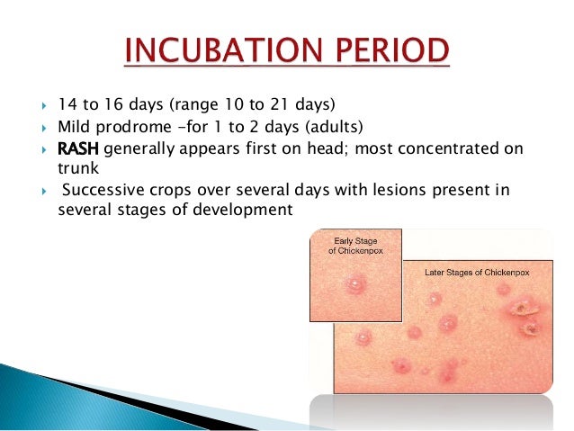 pic Early Stage Measles Smallpox Early Stage Measles Chicken Pox Symptoms chickenpox measles small pox rubella