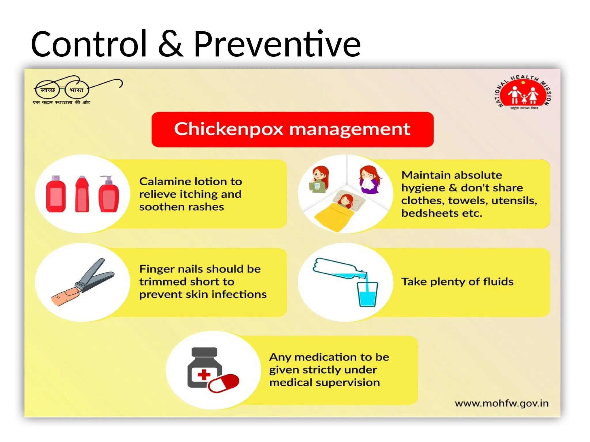 case presentation on chickenpox ppt chn.pptx