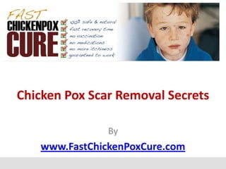 Chicken Pox Scar Removal Secrets

               By
   www.FastChickenPoxCure.com
 