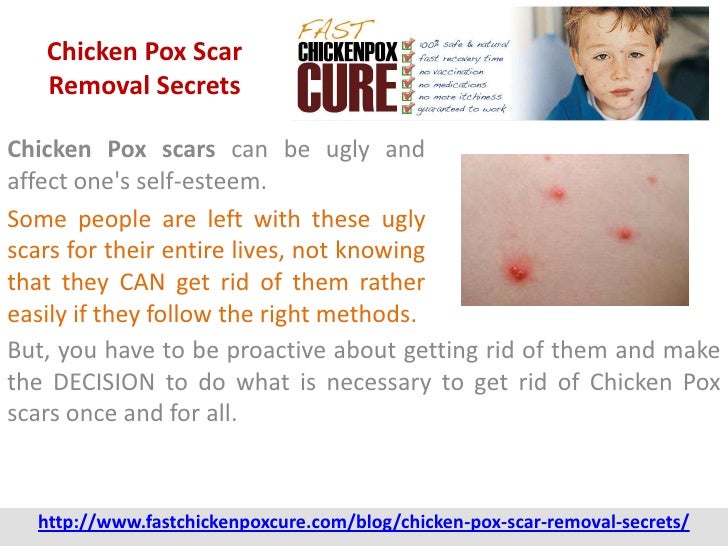 Chicken Pox Scar Removal Secrets