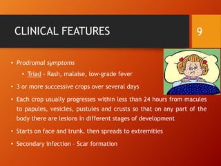 Chicken pox & Shingles | PPTX