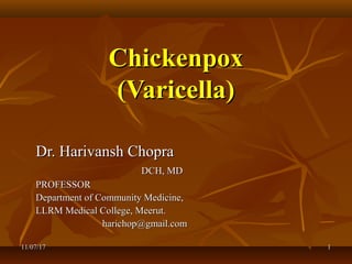 ChickenpoxChickenpox
(Varicella)(Varicella)
Dr. Harivansh ChopraDr. Harivansh Chopra
DCH, MDDCH, MD
PROFESSORPROFESSOR
Department of Community Medicine,Department of Community Medicine,
LLRM Medical College, Meerut.LLRM Medical College, Meerut.
harichop@gmail.comharichop@gmail.com
11/07/1711/07/17 11
 