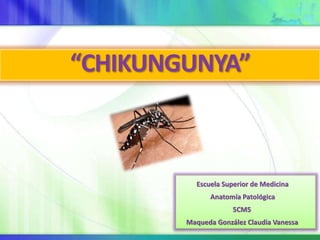 “CHIKUNGUNYA”
Escuela Superior de Medicina
Anatomía Patológica
5CM5
Maqueda González Claudia Vanessa
 