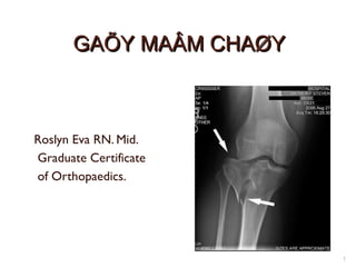 GAÕY MAÂM CHAØY

Roslyn Eva RN. Mid.
Graduate Certificate
of Orthopaedics.

1

 