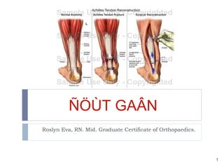 ÑÖÙT GAÂN
Roslyn Eva, RN. Mid. Graduate Certificate of Orthopaedics.

1

 