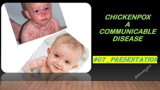 CHICKENPOX
A
COMMUNICABLE
DISEASE
 
