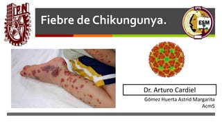 
Fiebre de Chikungunya.
Gómez Huerta Astrid Margarita
Acm5
Dr. Arturo Cardiel
 