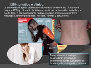 Sintomático o clínico:
La enfermedad aguda presenta un inicio súbito de fiebre alta (típicamente
mayor a 39°C) y dolor articular bilateral, simétrico, de intensidad variable que
puede llegar a ser incapacitante. También pueden presentarse exantema
maculopapular muy pruriginoso, náuseas, vómitos y conjuntivitis.
En aquellas personas que
desarrollarán síntomas, la
enfermedad puede evolucionar de
forma aguda, subaguda o crónica.
 