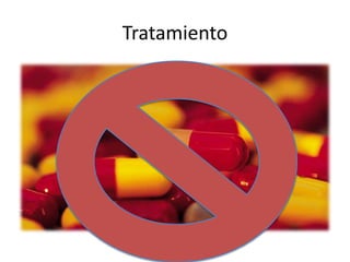 Tratamiento
 