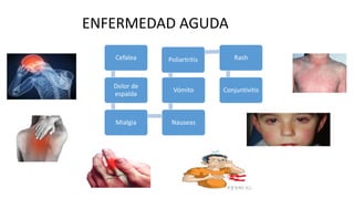Cefalea
Dolor de
espalda
Mialgia Nauseas
Vómito
Poliartritis Rash
Conjuntivitis
ENFERMEDAD AGUDA
 