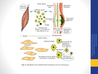 GuiadeManejodelChikungunya,
Septiembre2014,Secretariade
SaluddeHonduras
 