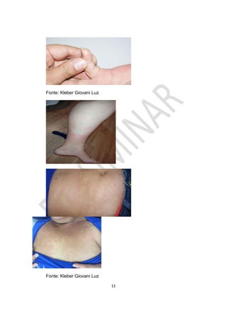 11
Fonte: Kleber Giovani Luz
Fonte: Kleber Giovani Luz
 