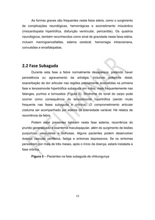 13
As formas graves são frequentes nesta faixa etária, como o surgimento
de complicações neurológicas, hemorrágicas e acometimento miocárdico
(miocardiopatia hipertrófica, disfunção ventricular, pericardite). Os quadros
neurológicos, também reconhecidos como sinal de gravidade nesta faixa etária,
incluem meningoencefalites, edema cerebral, hemorragia intracraniana,
convulsões e encefalopatias.
2.2 Fase Subaguda
Durante esta fase a febre normalmente desaparece, podendo haver
persistência ou agravamento da artralgia, incluindo poliartrite distal,
exacerbação da dor articular nas regiões previamente acometidas na primeira
fase e tenossinovite hipertrófica subaguda em mãos, mais frequentemente nas
falanges, punhos e tornozelos (Figura 5). Síndrome do túnel do carpo pode
ocorrer como consequência da tenossinovite hipertrófica (sendo muito
frequente nas fases subaguda e crônica). O comprometimento articular
costuma ser acompanhado por edema de intensidade variável. Há relatos de
recorrência da febre.
Podem estar presentes também nesta fase astenia, recorrência do
prurido generalizado e exantema maculopapular, além do surgimento de lesões
purpúricas, vesiculares e bolhosas. Alguns pacientes podem desenvolver
doença vascular periférica, fadiga e sintomas depressivos. Se os sintomas
persistirem por mais de três meses, após o início da doença, estará instalada a
fase crônica.
Figura 5 – Pacientes na fase subaguda de chikungunya
 