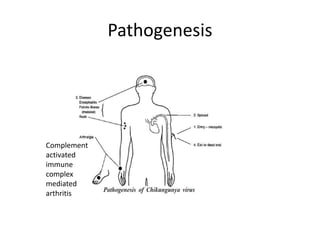 Pathogenesis
Complement
activated
immune
complex
mediated
arthritis
 