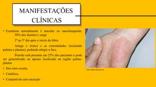 • Exantema normalmente é macular ou maculopapular,
50% dos doentes e surge
2º ao 5º dia após o início da febre.
Atinge o tronco e as extremidades (incluindo
palmas e plantas), podendo atingir a face.
Prurido está presente em 25% dos pacientes e pode
ser generalizado ou apenas localizado na região palmo-
plantar
• Dor retro-ocular,
• Calafrios,
• Conjuntivite sem secreção
MANIFESTAÇÕES
CLÍNICAS
Foto: Kleber Giovani Luz.
 