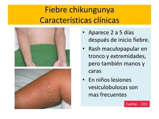 Fiebre chikungunya
Características clínicas
• Aparece 2 a 5 días
después de inicio fiebre.
• Rash maculopapular en
tronco y extremidades,
pero también manos y
caras
• En niños lesiones
vesiculobulosas son
mas frecuentes
Fuente.- CDC
 