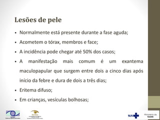 Lesões de pele
• Normalmente está presente durante a fase aguda;
• Acometem o tórax, membros e face;
• A incidência pode chegar até 50% dos casos;
• A manifestação mais comum é um exantema
maculopapular que surgem entre dois a cinco dias após
início da febre e dura de dois a três dias;
• Eritema difuso;
• Em crianças, vesículas bolhosas;
 