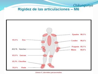 Chikungunya Junio 2014 Slide 41